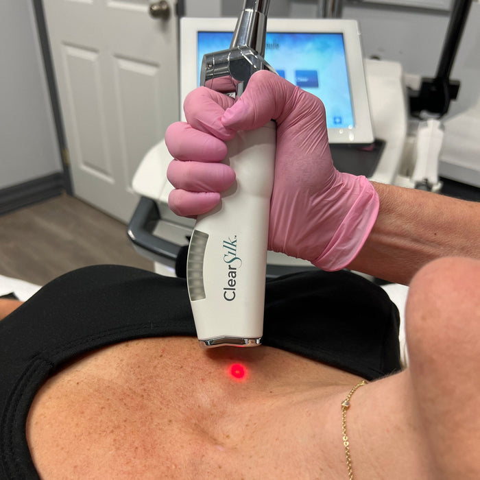 ClearSilk - MD Aesthetics