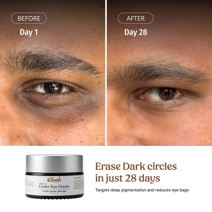 Vilvah Under Eye Cream targets deep pigmentation and reduces eye bags