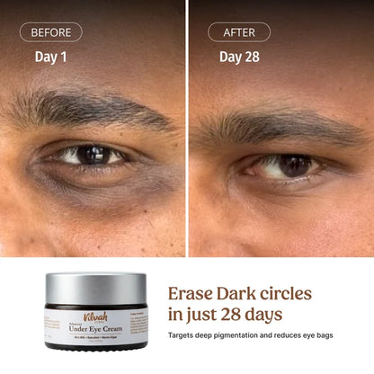 Vilvah Under Eye Cream targets deep pigmentation and reduces eye bags