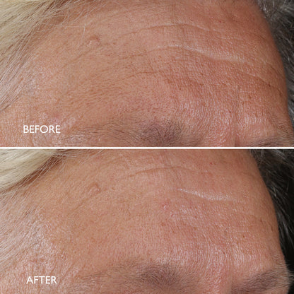 Age Benefit™ Night Renewal Cream 30ml