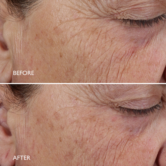 Age Benefit™ Night Renewal Cream 30ml