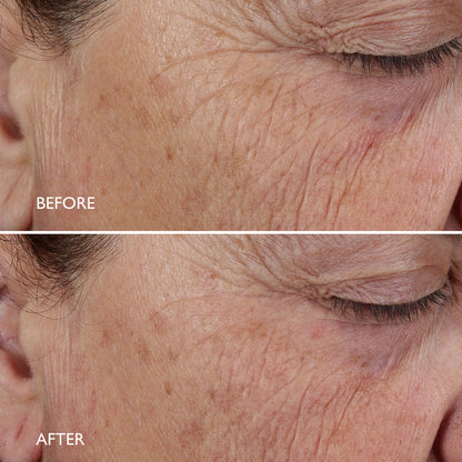 Age Benefit™ Night Renewal Cream 30ml