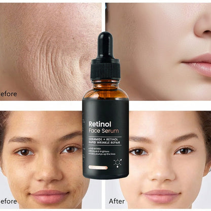 Anti-Aging Retinol Face Serum