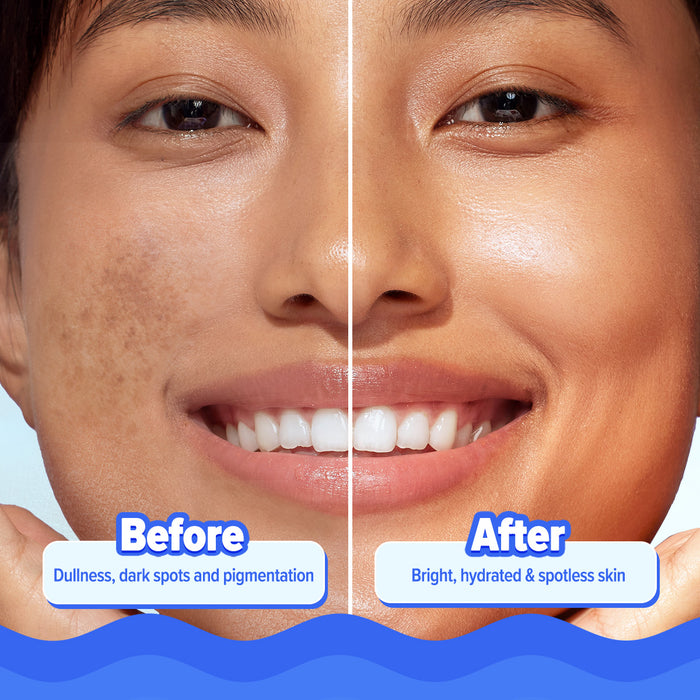 Before-and-after showing a fresher skin look