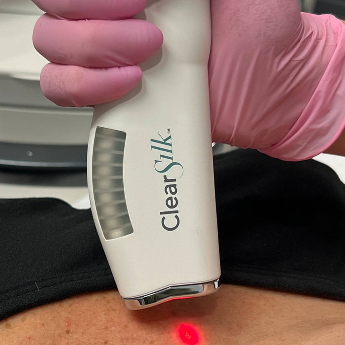 Clear Silk - MD Aesthetics