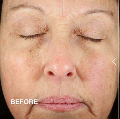 DERMA E anti wrinkle renewal cream كريم علاج التجاعيد من ديرما