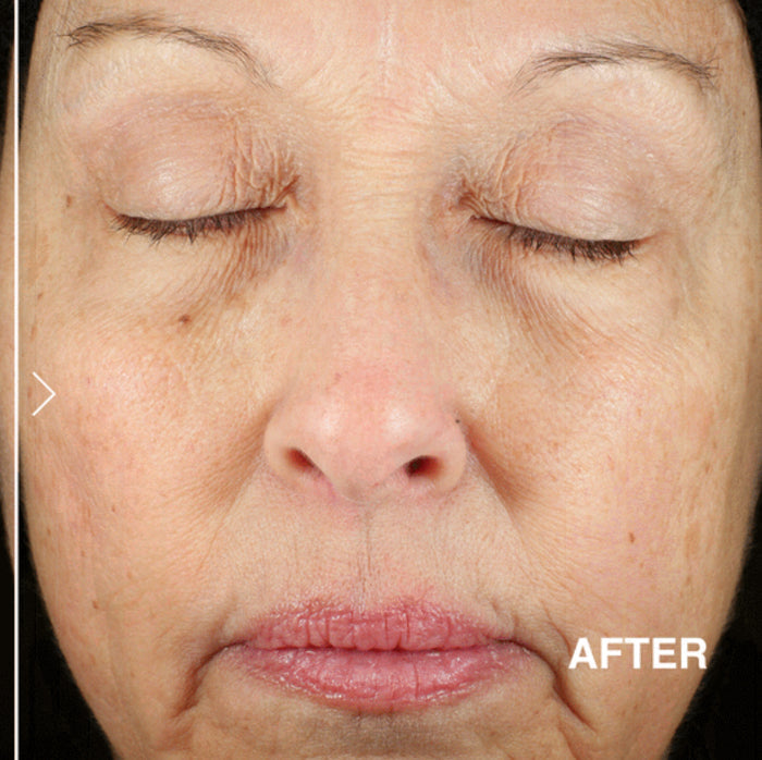 DERMA E anti wrinkle renewal cream كريم علاج التجاعيد من ديرما