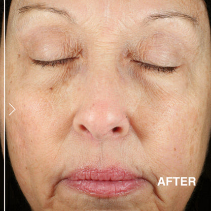 DERMA E anti wrinkle renewal cream كريم علاج التجاعيد من ديرما