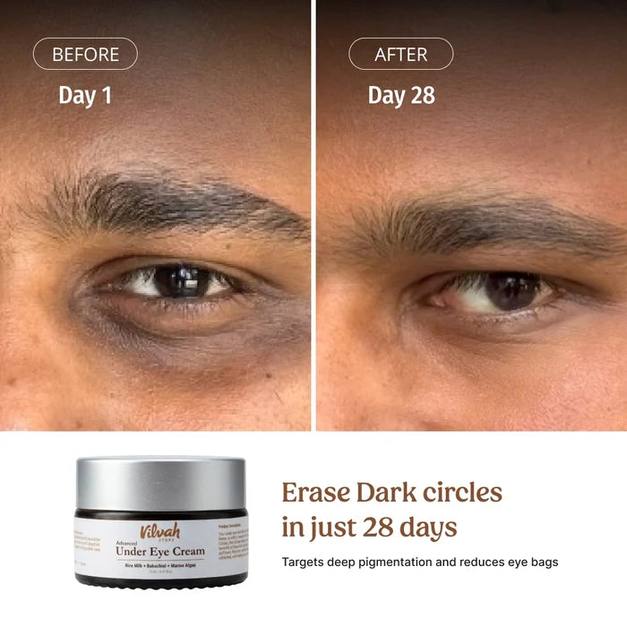 Vilvah Under Eye Cream targets deep pigementation and reduces eye bags