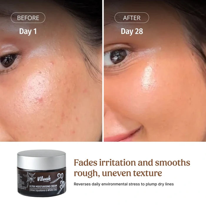 Vilvah Ultra Moisturising Cream fades Irritation and smoths Rough, Uneven Texture