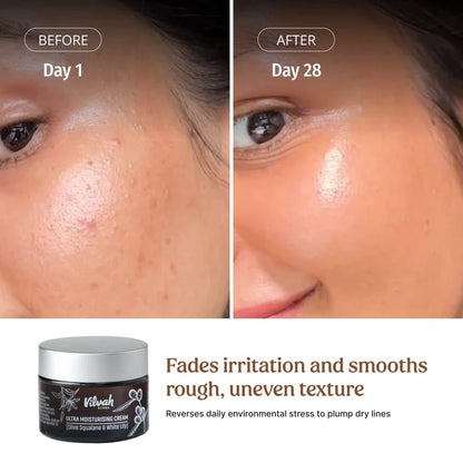 Vilvah Ultra Moisturising Cream fades Irritation and smoths Rough, Uneven Texture