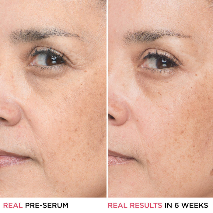 IT Cosmetics Bye Bye Lines Hyaluronic Acid Serum 30ml bottle, clear glass container with dropper for beauty skincare.