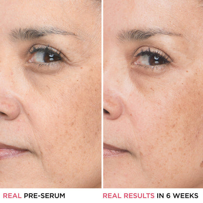 IT Cosmetics Bye Bye Lines Hyaluronic Acid Serum 30ml bottle, clear glass container with dropper for beauty skincare.