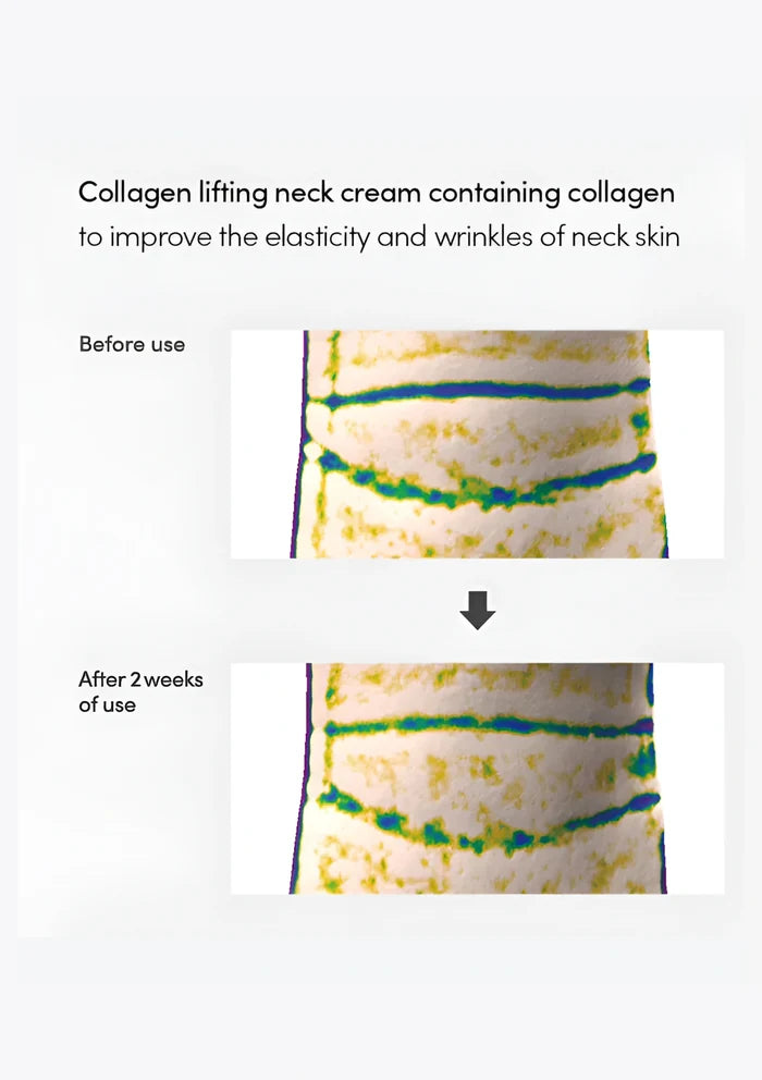 Before-and-after close-up of neck skin after two weeks of LAGOM Collagen Lifting Neck Cream use
