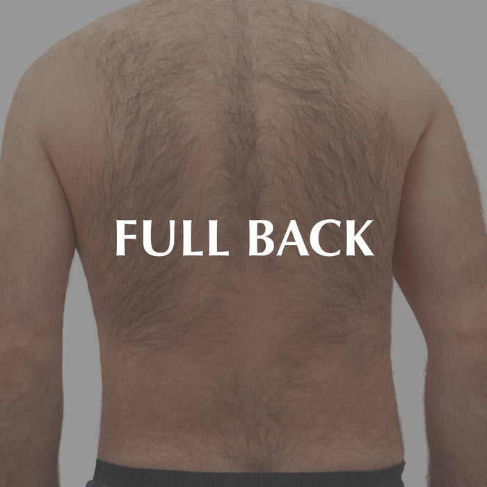 Laser Hair Removal - Body - MD Aesthetics