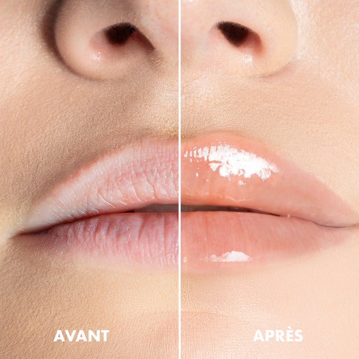 Looky Lèvres Peptide Therapy #5 Brunch