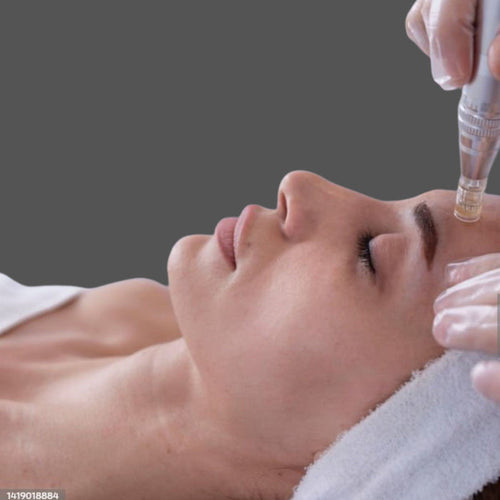 Microneedling