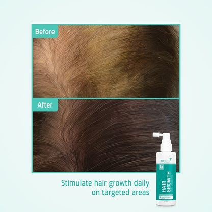 Neofollics hair growth lotion (7% Neoxyl)