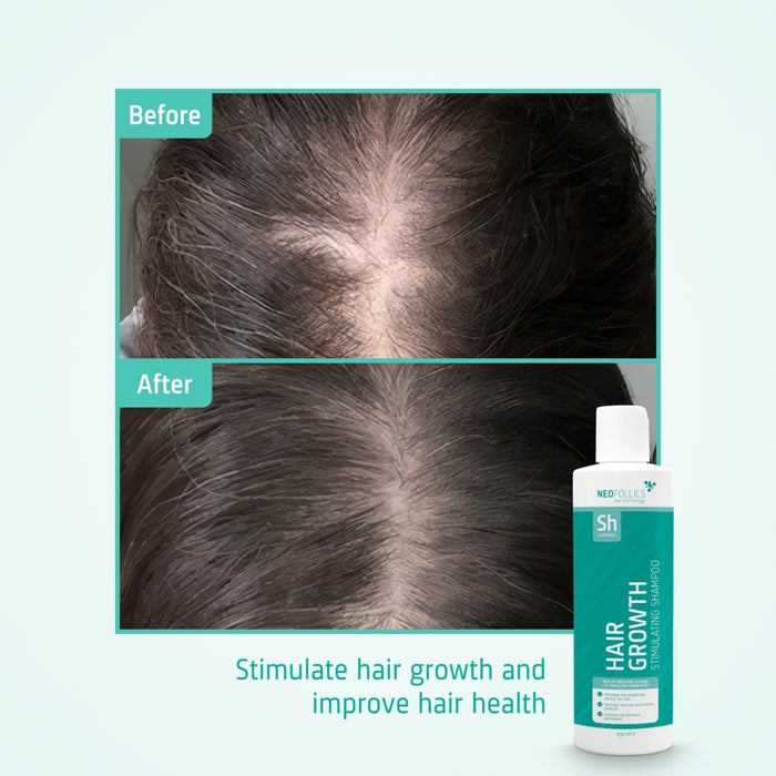 Neofollics hair growth shampoo (250 ml)