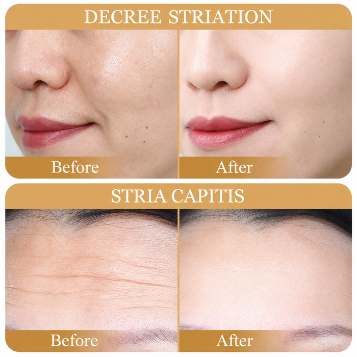 Pre-Launch Deal – SADOER Collagen Anti-Aging Sheet Masks