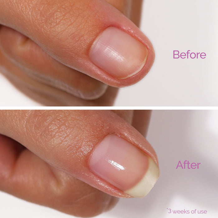 Close-up of a thumbnail comparison: the "before" image shows a short, dull nail; the "after" shows a longer, shinier nail after three weeks using LONDONTOWN Sheer Strength Nail Blush - Concord, a 2-in-1 hardener and glow booster.