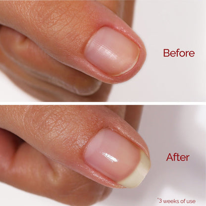 Close-up of a fingernail before and after three weeks of using LONDONTOWN Sheer Strength Nail Blush - Poppy; the nail looks longer, healthier, and noticeably shinier in the "after" image.