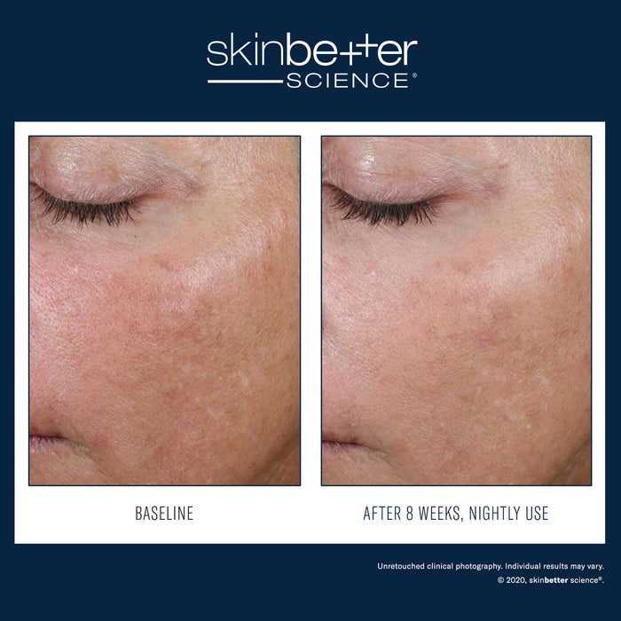 SkinBetter AlphaRet Overnight Cream 30ml