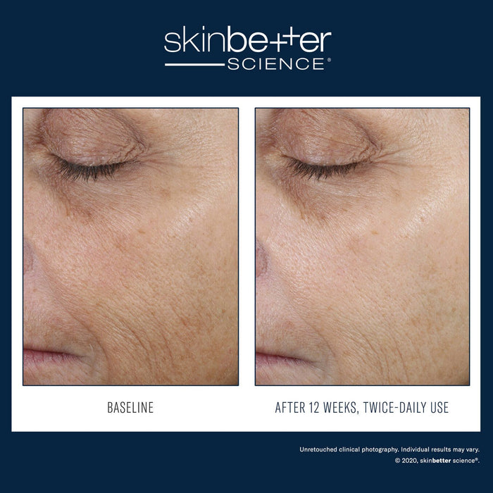 SkinBetter Even Tone Correcting Serum 50ml