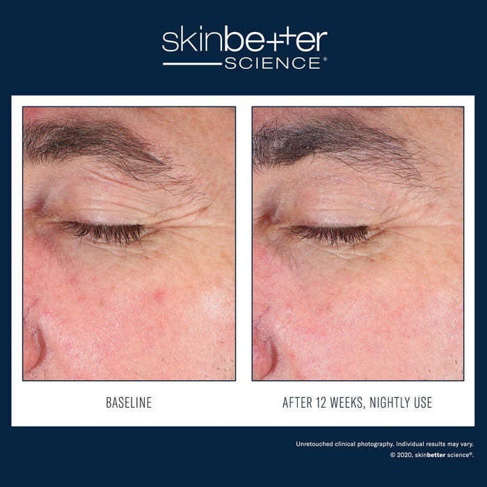 SkinBetter EyeMax AlphaRet Overnight Cream 15ml