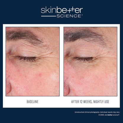 SkinBetter EyeMax AlphaRet Overnight Cream 15ml