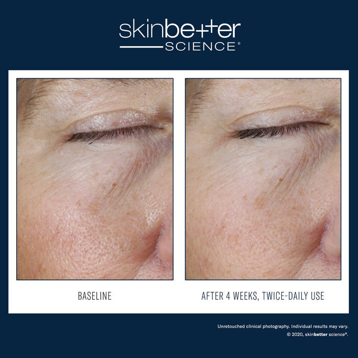 SkinBetter Instant Effect Gel EYE 15ml