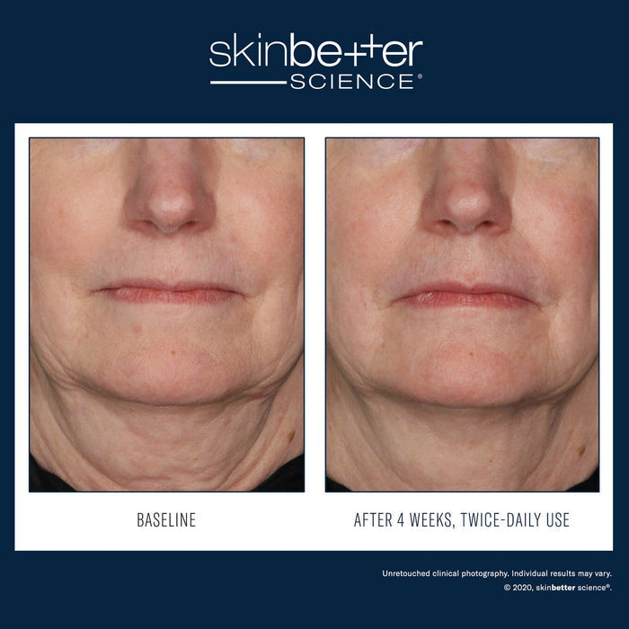 SkinBetter InterFuse Treatment Cream FACE & NECK 30ml
