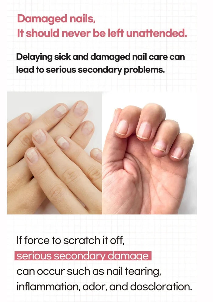 Comparison of healthy and damaged nails with text about nail care.