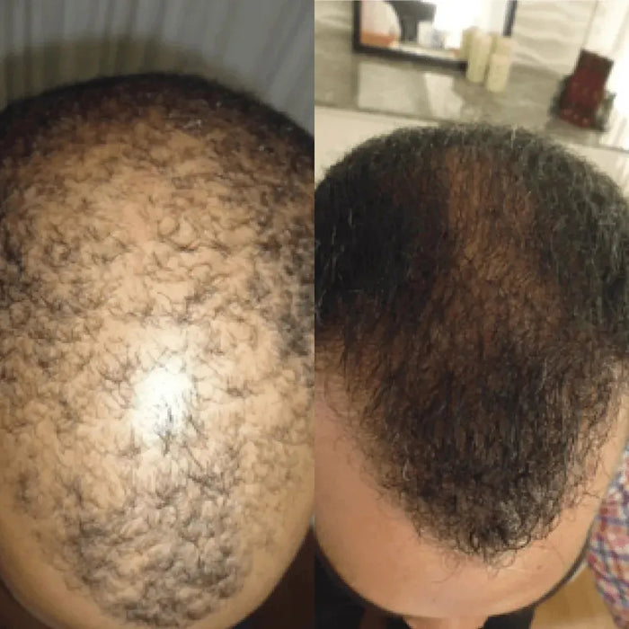 Spectral DNC-N (Nanoxidil) lotion - Hairgivers