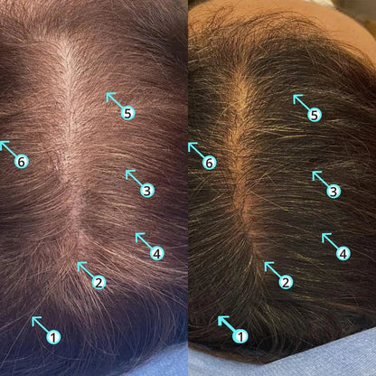 Spectral.DNC-S (Melanex) lotion - Hairgivers
