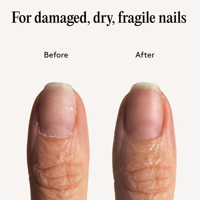 TLC Nail Serum