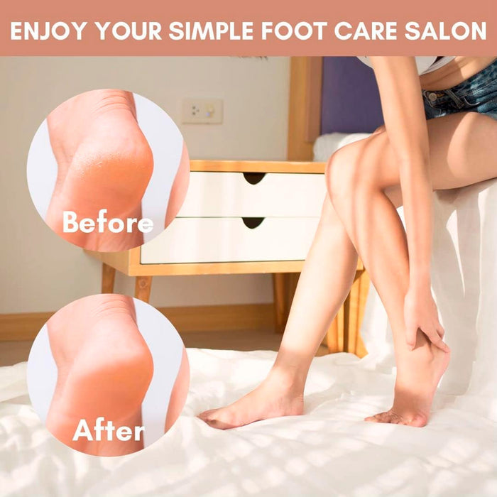 Yolanda Callus Remover Foot File