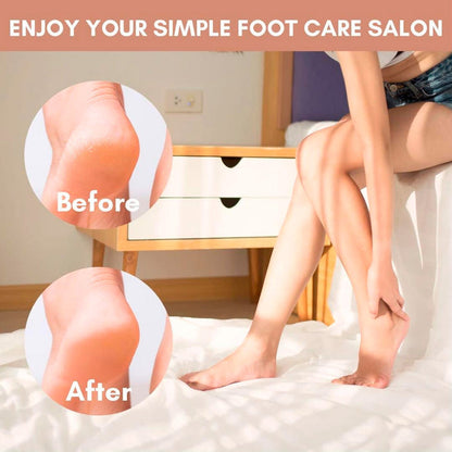 Yolanda Callus Remover Foot File